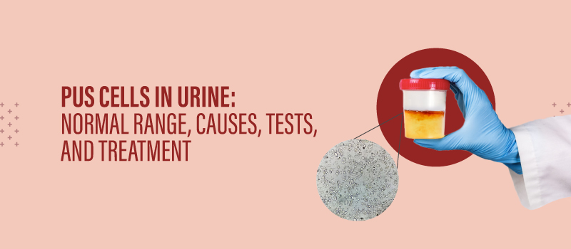 Kidney diseases