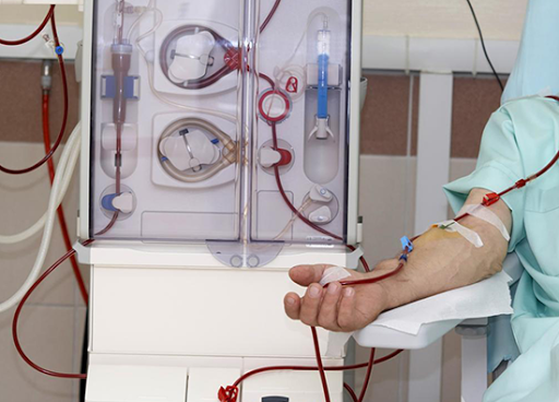 dialysis