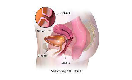 female urology 