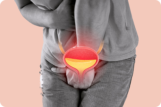 BPH Symptoms